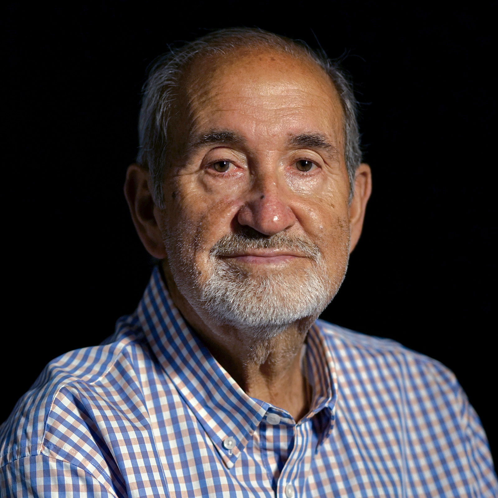 JOSÉ, 79 años. Fibrilación auricular e insuficiencia tricúspide. Cierre orejuela (2022) y Triclip (2023).