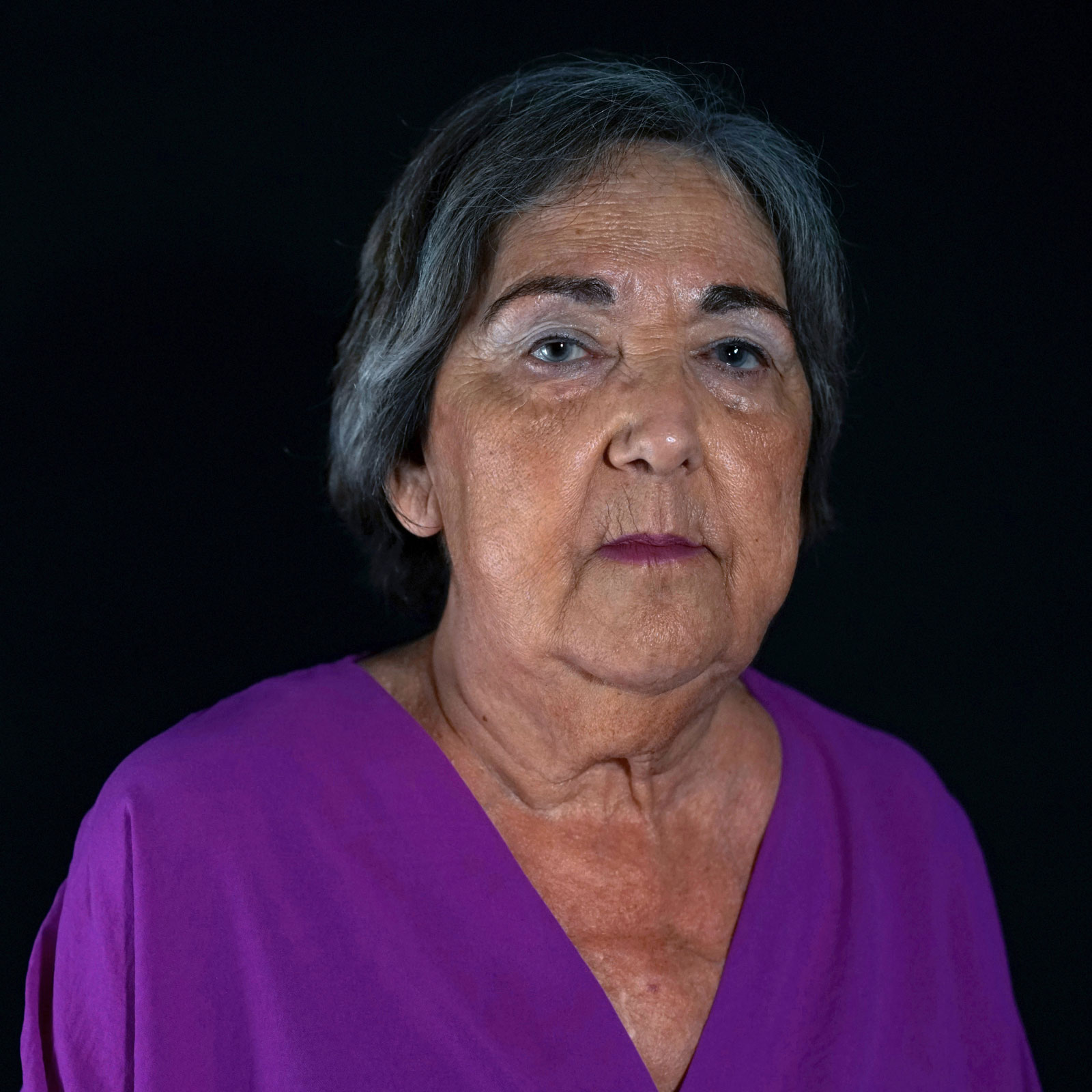 FRANCISCA, 67 años. Insuficiencia mitral severa. MitraClip (2023).