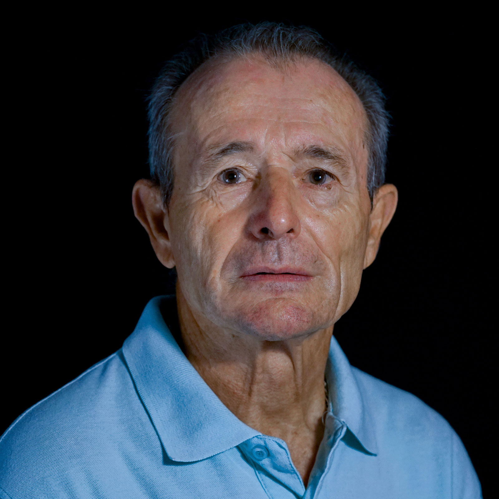 ANTONIO, 71 años. Reemplazo valvular aórtico previo. Implante TAVI (2022).