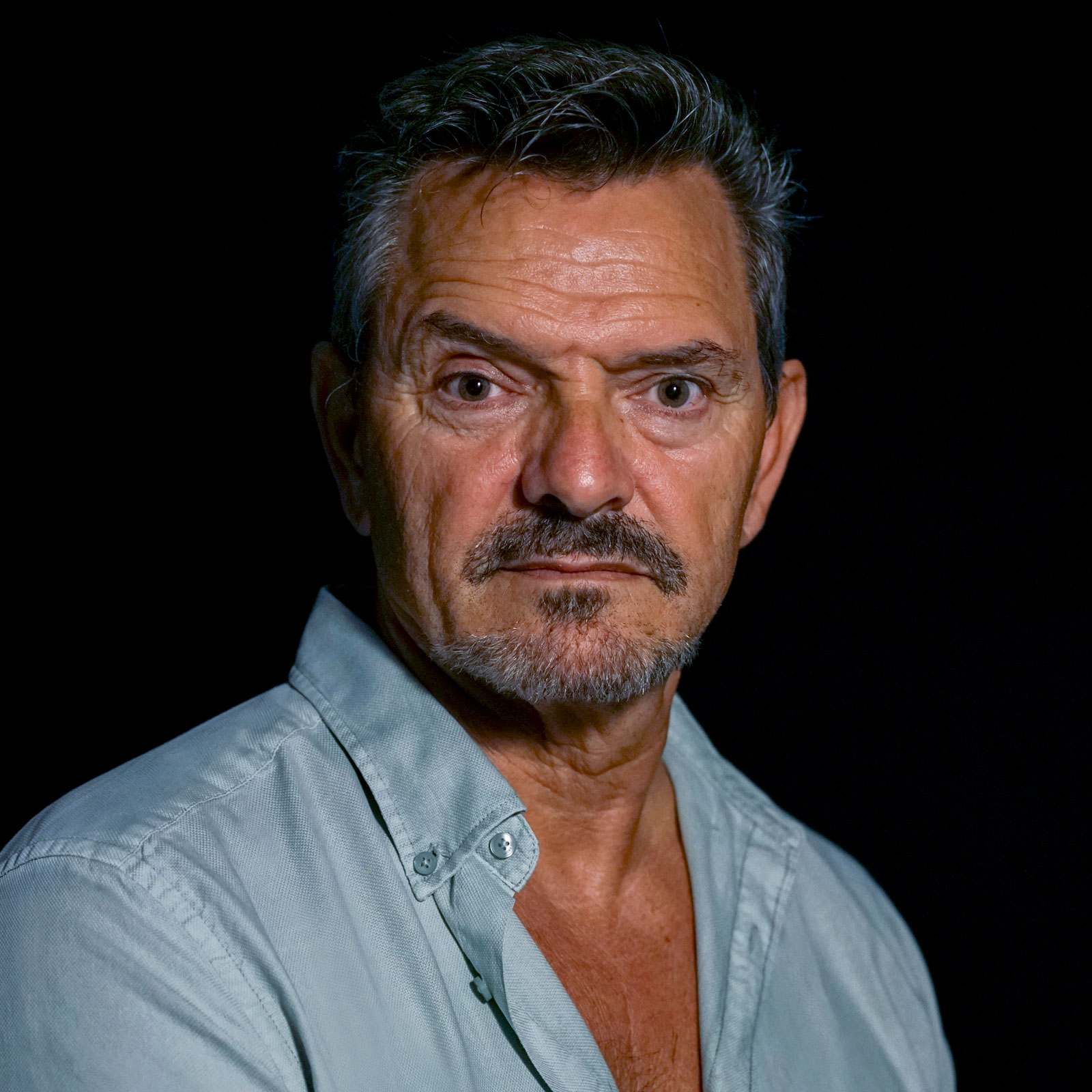 JOSÉ LUÍS, 64 años. Fibrilación auricular. Ablación venas pulmonares (2023).