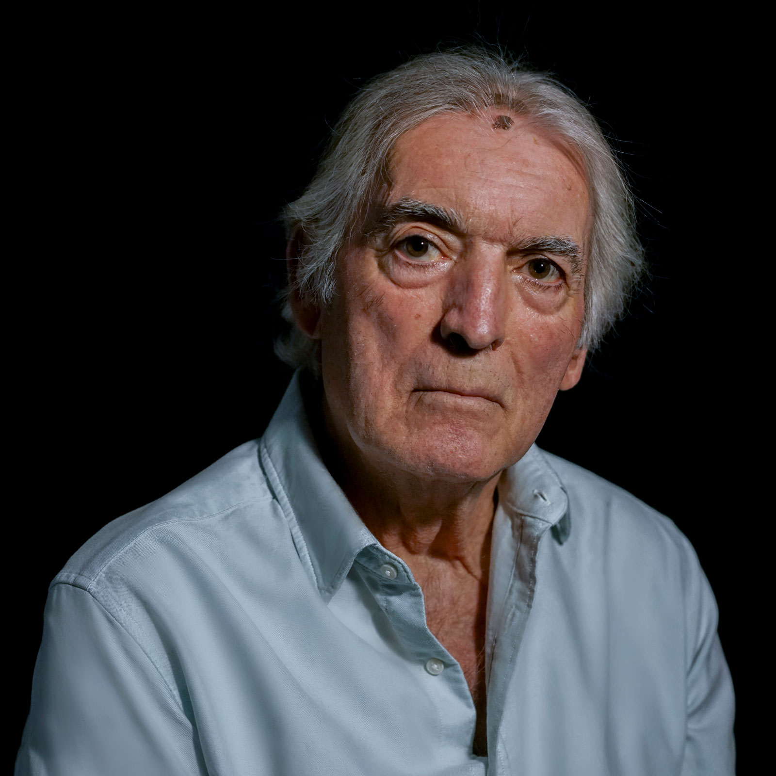 FRANCISCO, 65 años. Insuficiencia mitral severa. Implante MitraClip (2020).