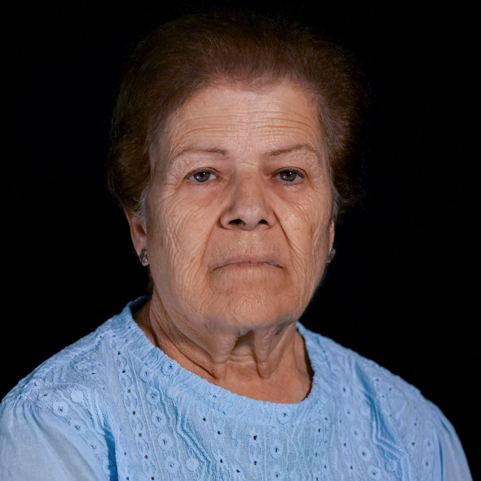 ANA, 74 años. Insuficiencia tricúspide masiva. Implante TriClip (2023).
