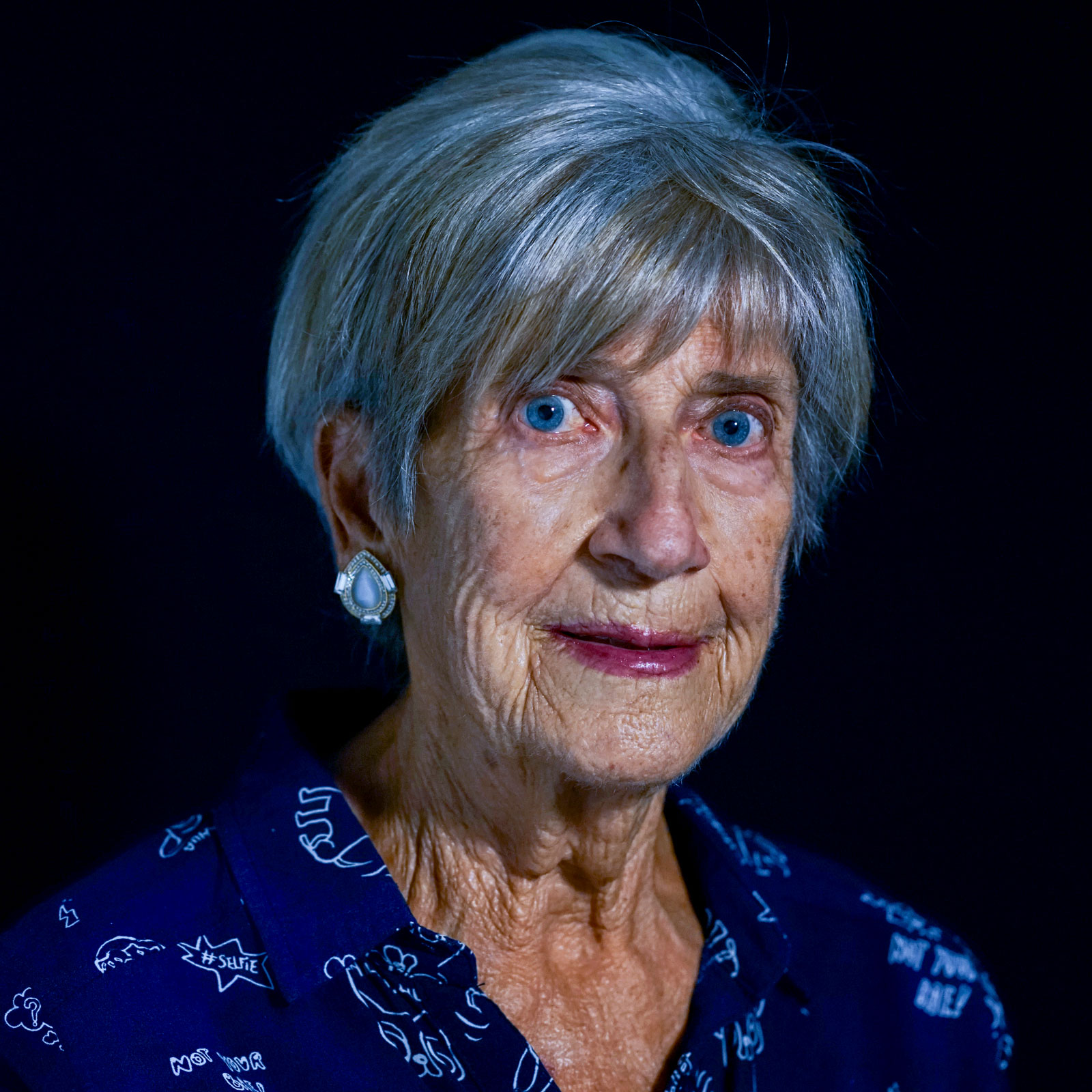 MARIA JOSEFA, 75 años. Insuficiencia mitral severa. Implante MitraClip (2024).