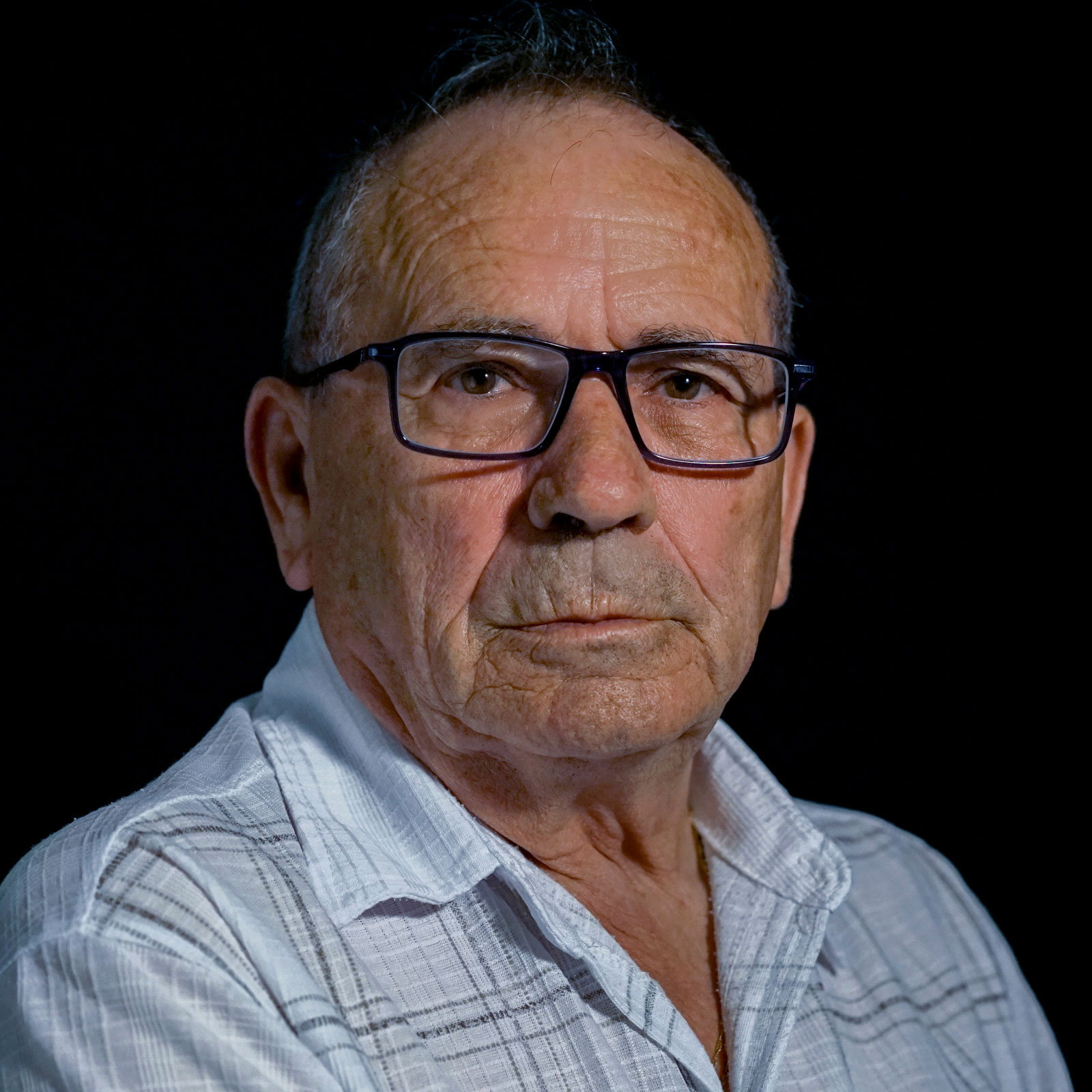 JUAN ANTONIO, 70 años. Cardiopatía isquémica con revascularización previa y ángor refractario. Implante reductor seno coronario (2023).