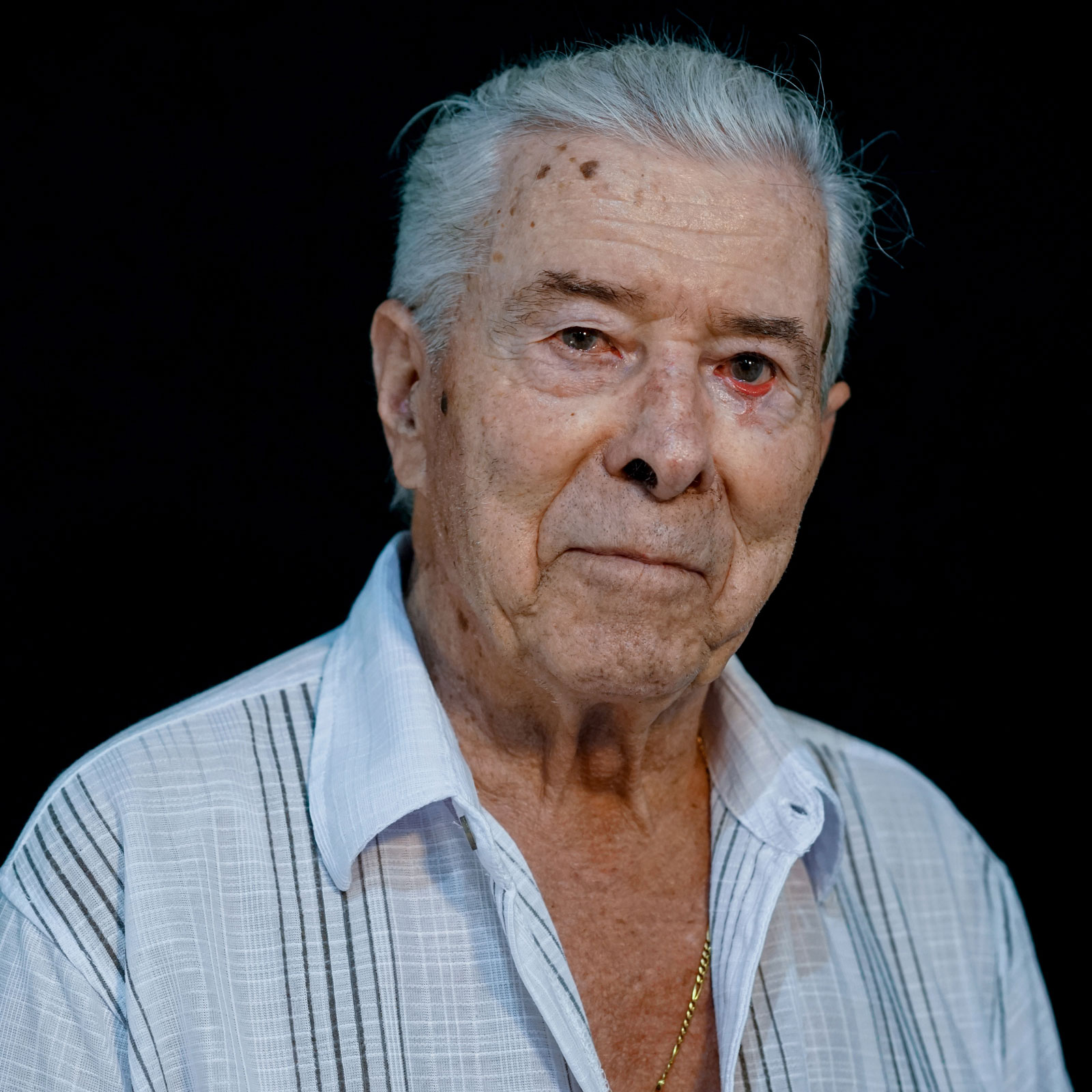 JOSÉ, 82 años. Estenosis aórtica severa. Implante TAVI (2022).