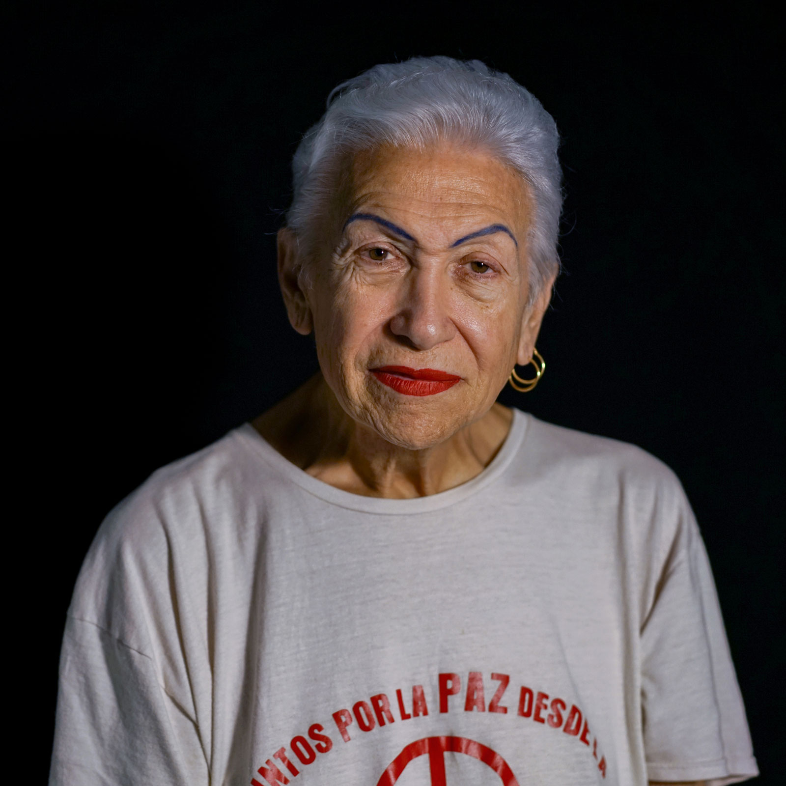 DORIS, 79 años. Estenosis aórtica severa y shock cardiogénico. Implante de TAVI (2022).
