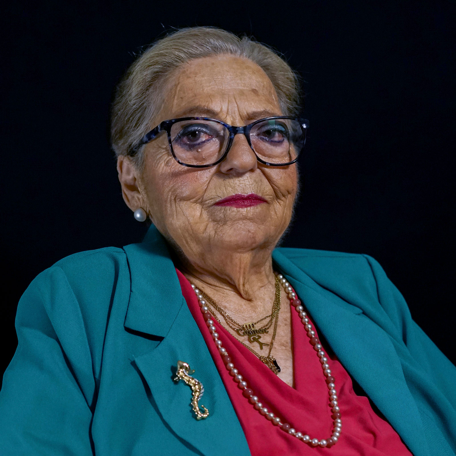 MARI CARMEN, 74 años. Insuficiencia tricúspide con alto riesgo quirúrgico. Implante TriClip (2024).