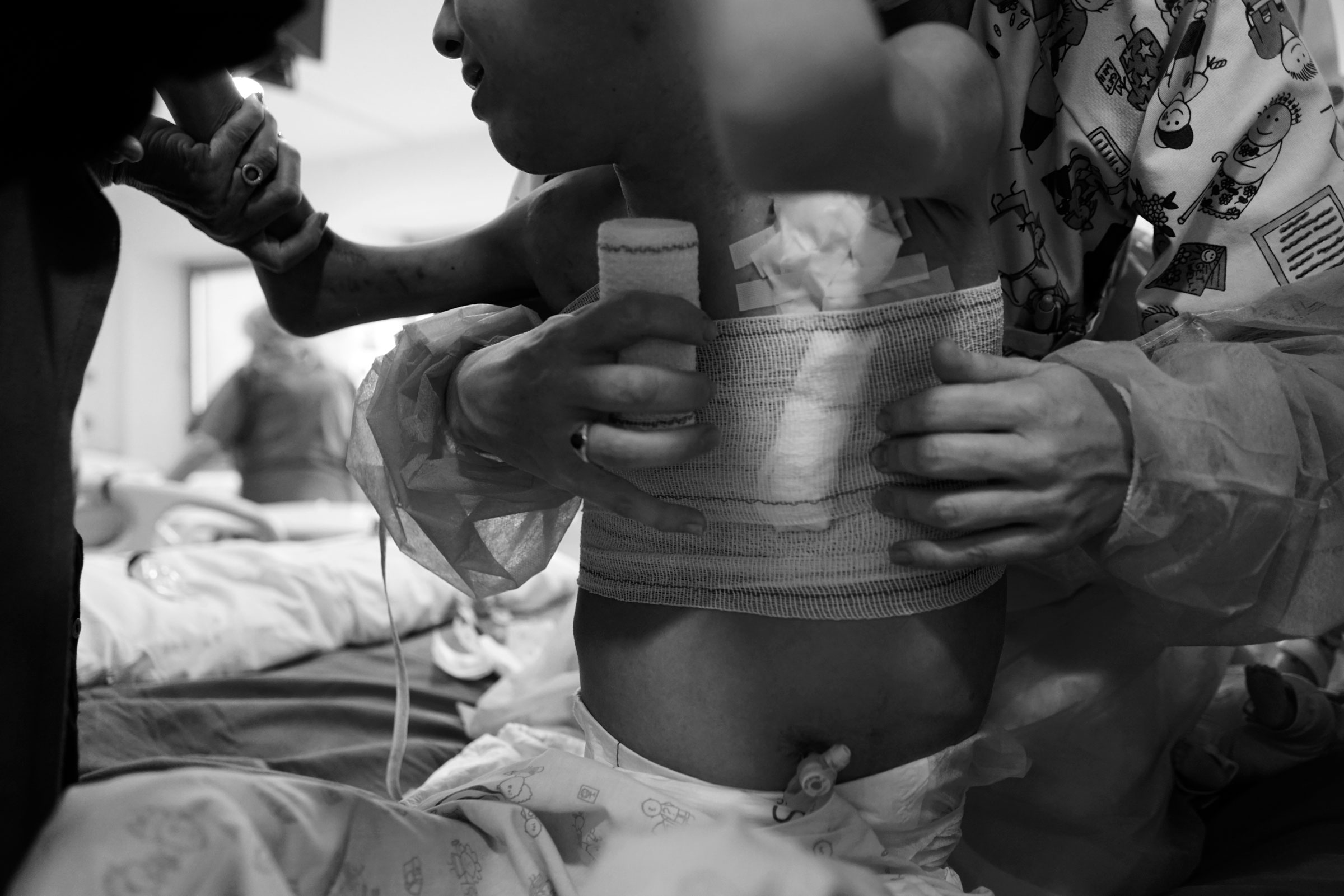Málaga, España. Dos enfermeras protegen el catéter de hemodiálisis de un niño mediante un vendaje en la Unidad de hemodiálisis del Hospital Materno-Infantil del Hospital Universitario Regional de Málaga (HURM).